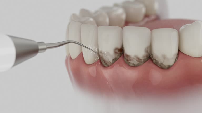 Trusted Dental Implants service in Auburn, GA - Dentist Open Now